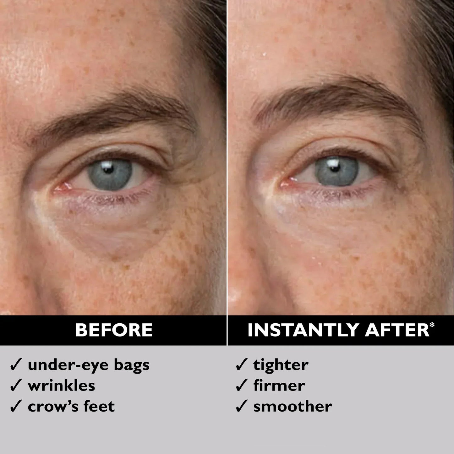 Eye Bag Quick Eraser, Tightens, Firms, & Blurs Wrinkles